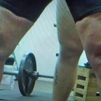 Legs