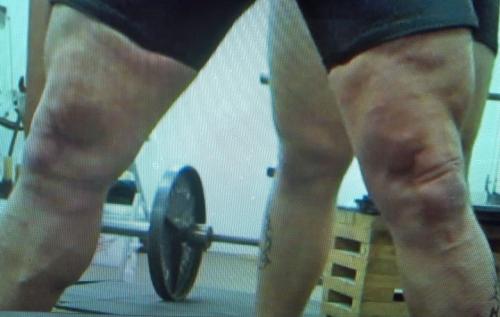 Legs
